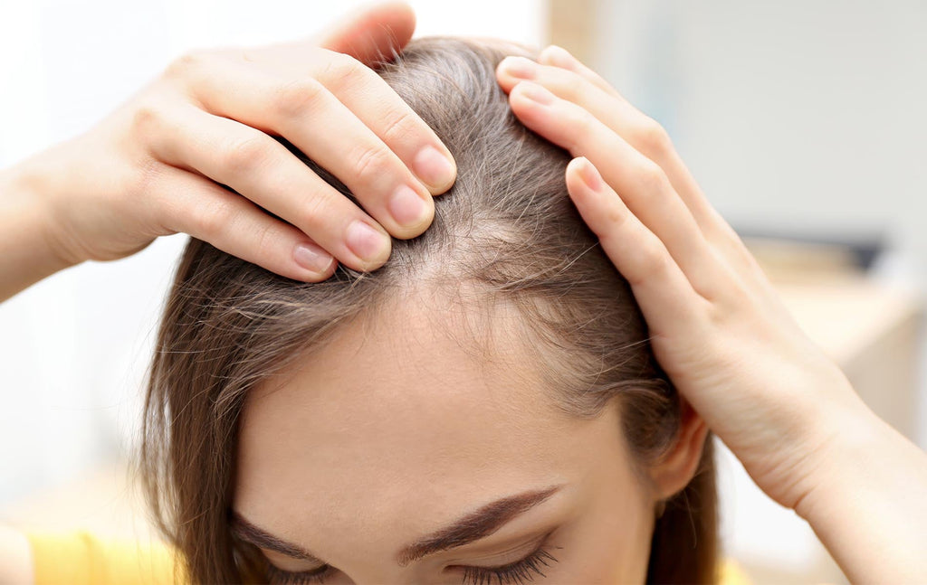 How to Stop Hair Loss and Regrow Hair Naturally